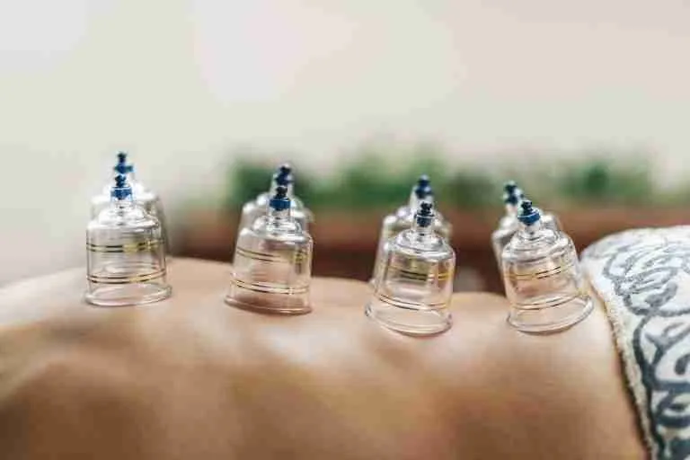 The 11 Shocking Health Benefits Of Cupping Therapy