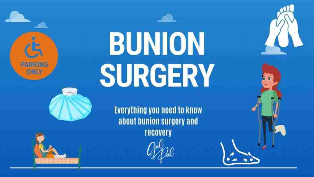 Everything you need to know about bunion surgery