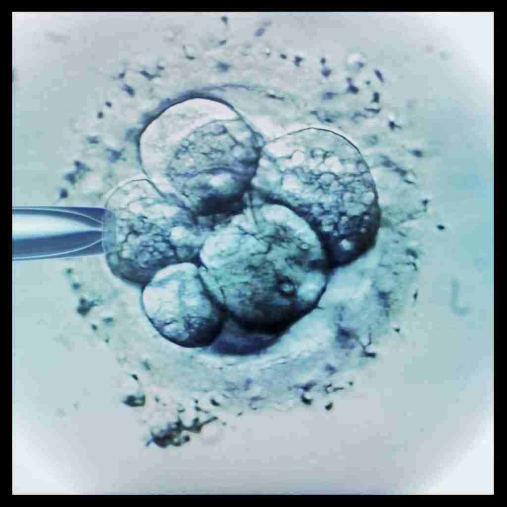 IVF egg