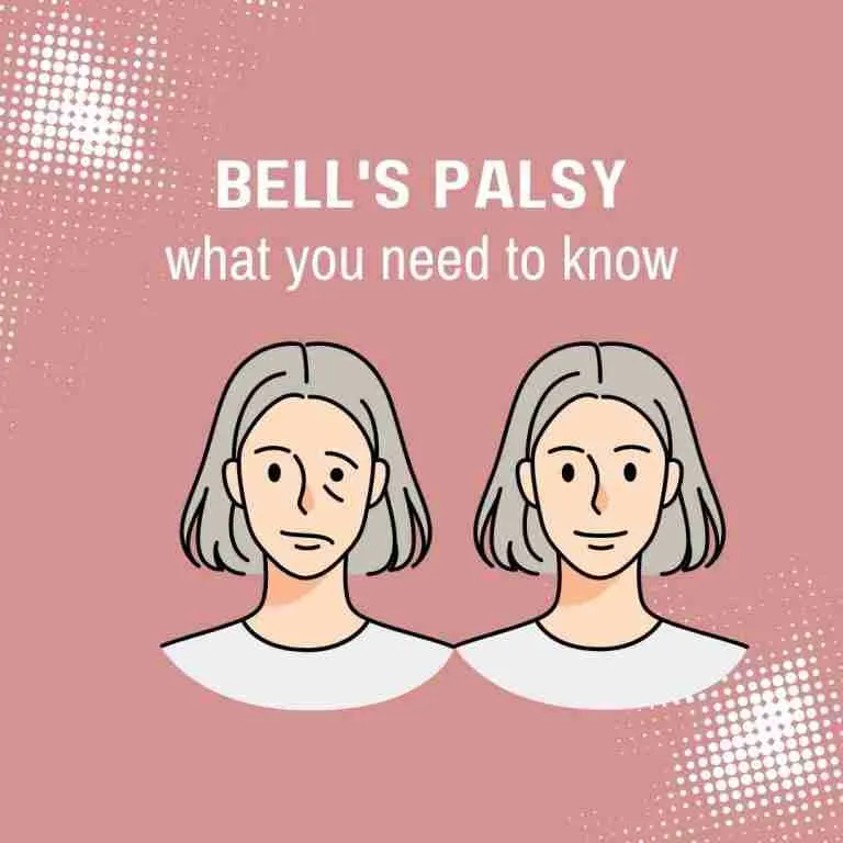 Bell’s palsy after covid-what you should know