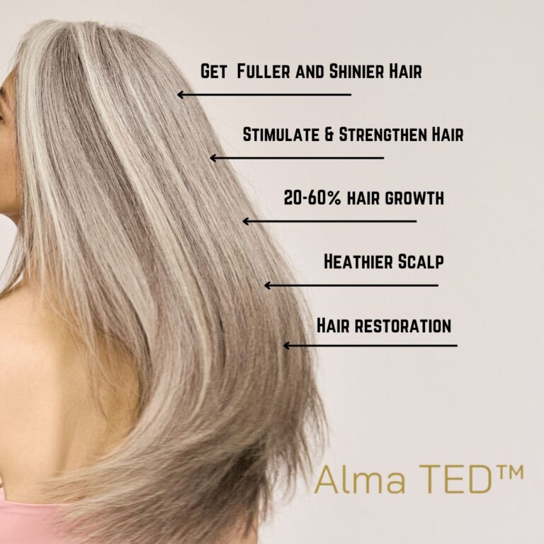 Exciting new Alma TED hair restoration treatment -benefits-proven results