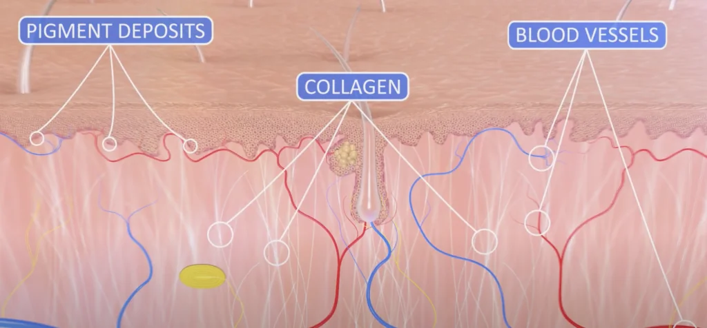 methylation data  from Haut.ai skin GPT