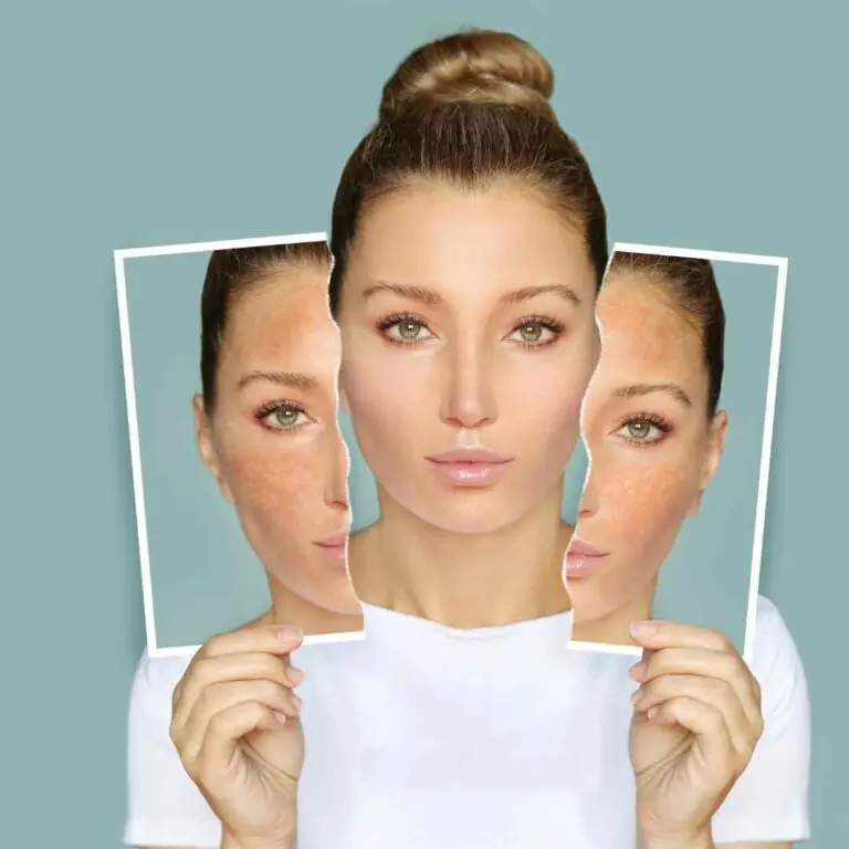 The best peels for at home