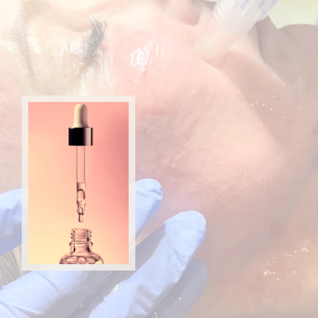 My microneedling with exosome personal review. Dropper of exosomes 