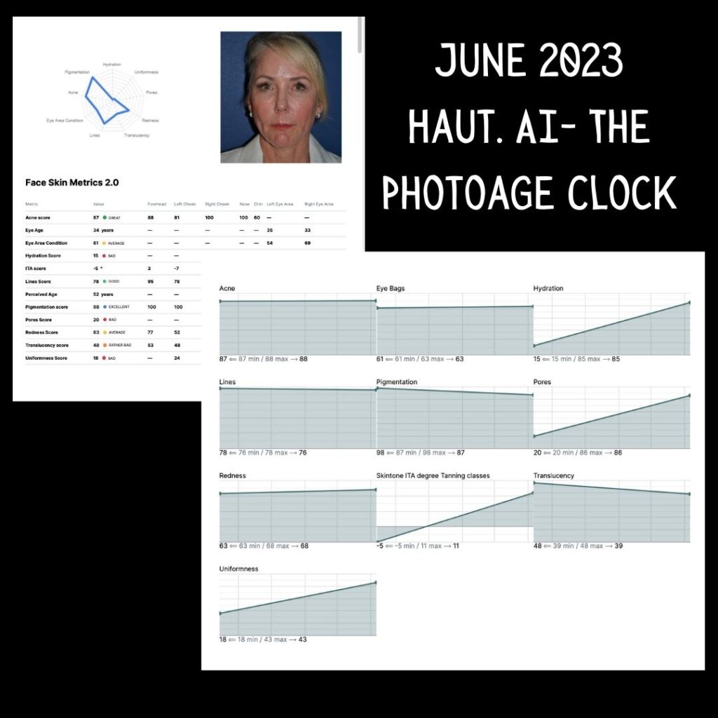 June photoage Clock results 