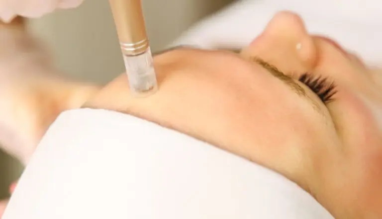 Beautician cosmetologist doing procedure fractional microneedle mesotherapy with Dermapen.