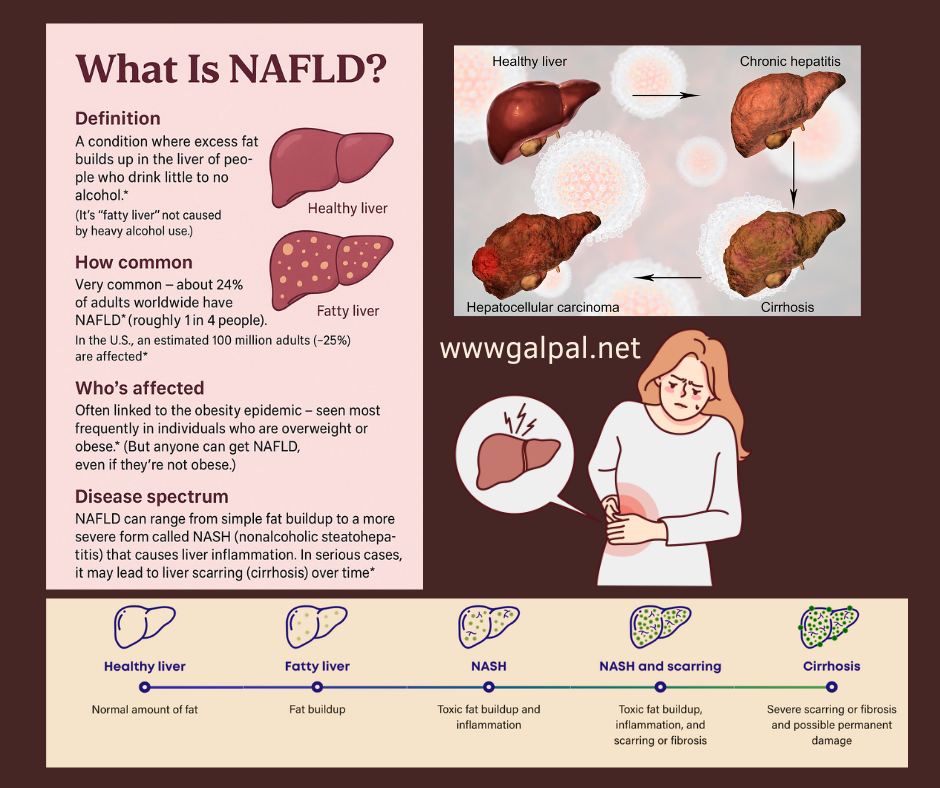 wHAT IS nafld?